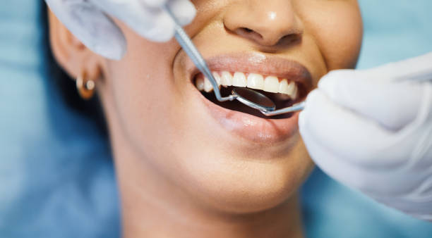 Best Emergency Root Canal Therapy in Ridgeland, SC