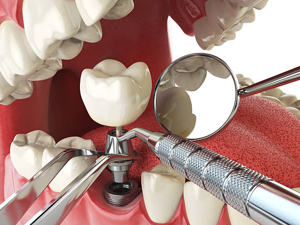 Best Urgent Dental Care for Toothaches in Ridgeland, SC